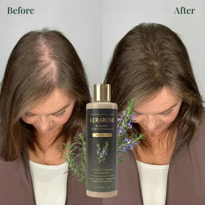 Rosemary Hydrolyzed Keratin Hair Shampoo P1