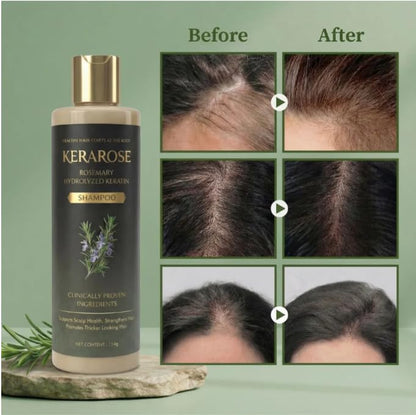 Rosemary Hydrolyzed Keratin Hair Shampoo P1